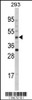 Western blot analysis of AADAC Antibody in 293 cell line lysates (35ug/lane)