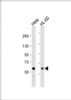 Western Blot at 1:2000 dilution Lane 1: Hela whole cell lysate Lane 2: HL-60 whole cell lysate Lysates/proteins at 20 ug per lane.