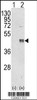 Western blot analysis of CEBPB using rabbit polyclonal CEBPB Antibody using 293 cell lysates (2 ug/lane) either nontransfected (Lane 1) or transiently transfected with the CEBPB gene (Lane 2) .