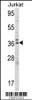 Western blot analysis of ALAD Antibody in Jurkat cell line lysates (35ug/lane)