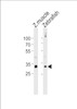 Western blot analysis of lysates from zebra fish muscle, Zebrafish tissue lysate (from left to right) , using DANRE HOXD4 Antibody at 1:1000 at each lane.