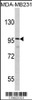 Western blot analysis of DLGAP1 Antibody in MDA-MB231 cell line lysates (35ug/lane)