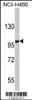 Western blot analysis of EPB41L4B Antibody in NCI-H460 cell line lysates (35ug/lane) (2ug/ml)