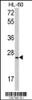 Western blot analysis of SFRS1 Antibody in HL-60 cell line lysates (35ug/lane)