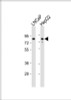 Western Blot at 1:1000 dilution Lane 1: LNCaP whole cell lysate Lane 2: HepG2 whole cell lysate Lysates/proteins at 20 ug per lane.