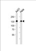Western blot analysis of lysates from A431, Hela cell line (from left to right) , using GTF2I Antibody at 1:1000 at each lane.