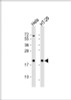 Western Blot at 1:1000 dilution Lane 1: Hela whole cell lysate Lane 2: HT-29 whole cell lysate Lysates/proteins at 20 ug per lane.