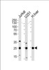 Western blot analysis of lysates from Jurkat, U251 cell line and human liver tissue (from left to right) , using GSTM1 Antibody at 1:1000 at each lane.