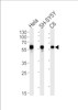 Western blot analysis in Hela, SH-SY5Y, rat C6 cell line lysates (35ug/lane) .
