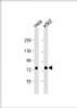 Western Blot at 1:1000 dilution Lane 1: Hela whole cell lysate Lane 2: K562 whole cell lysate Lysates/proteins at 20 ug per lane.