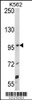 Western blot analysis of UNC5C Antibody in K562 cell line lysates (35ug/lane)