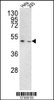 Western blot analysis of TMPRSS3 Antibody in Hela, 293 cell line lysates (35ug/lane)