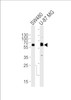 Western blot analysis of lysates from SW480, U-87 MG cell line (from left to right) , using TH Antibody at 1:1000 at each lane.