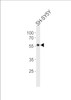 Western blot analysis in SH-SY5Y cell line lysates (35ug/lane) .This demonstrates the detected the TH protein (arrow) .