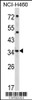 Western blot analysis of CER1 Antibody in NCI-H460 cell line lysates (35ug/lane)