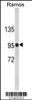 Western blot analysis of CR2 Antibody in Ramos cell line lysates (35ug/lane)