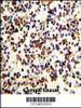 Formalin-fixed and paraffin-embedded human Lymph reacted with CR2 Antibody, which was peroxidase-conjugated to the secondary antibody, followed by DAB staining.