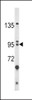 Western blot analysis of BICC1 Antibody in HL-60 cell line lysates (35ug/lane)