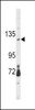 Western blot analysis of CLEC16A Antibody in mouse brain tissue lysates (35ug/lane)