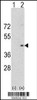 Western blot analysis of Aurora-A using rabbit polyclonal Aurora-A Antibody using 293 cell lysates (2 ug/lane) either nontransfected (Lane 1) or transiently transfected with the Aurora-A gene (Lane 2) .