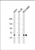 Western Blot at 1:1000 dilution Lane 1: A431 whole cell lysate Lane 2: HL-60 whole cell lysate Lane 3: NCI-H460 whole cell lysate Lysates/proteins at 20 ug per lane.