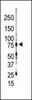 Western blot analysis of anti-PKC gamma C-term Pab in mouse brain lysate. PKC gamma was detected using purified Pab.