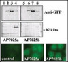 western blot analysis of GFP fusion protein expression in Panc-1 cells by using an anti-GFP antibody. Lanes 1 and 5: non-transfected cells; lanes 2 and 6: GFP-PKD-transfected cells; lanes 3 and 7: GFP-PKD2-transfected cells; lanes 4 and 8: GFP-PKD3 transfected cells. Center panel, western blot analysis of GFP fusion protein expression in Panc-1 cells by using PKD3 N-term and C-term antibodies. Lower panel, indirect immunofluorescence analysis of GFP-PKD3 fusion protein expression in Panc-1 cells by using antibodies. Data courtesy of Dr. Osvaldo Rey, University of California Los Angeles.