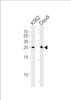 Western blot analysis of lysates from K562, Daudi cell line (from left to right) , using MOB4A Antibody at 1:1000 at each lane.