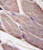 Formalin-fixed and paraffin-embedded human skeletal muscle tissue reacted with PDK4-E265, which was peroxidase-conjugated to the secondary antibody, followed by DAB staining.