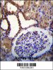 WNK3 (PRKWNK3) Antibody immunohistochemistry analysis in formalin fixed and paraffin embedded human kidney tissue followed by peroxidase conjugation of the secondary antibody and DAB staining.