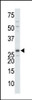 Antibody is used in Western blot to detect DTYMK in mouse colon tissue lysate.