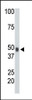 Antibody is used in Western blot to detect CHK in mouse heart tissue lysate.