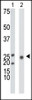 Antibody is used in Western blot to detect KHK in mouse liver tissue lysate (Lane 1) and 293 cell lysate (Lane 2) .