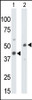 Antibody is used in Western blot to detect CKMT1 in mouse colon tissue lysate (Lane 1) and ZR-75-1 cell lysate (Lane 2) .