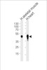 Western blot analysis of lysates from human skeletal muscle and heart tissue lysates (from left to right) , using CKMT2 Antibody (D406) at 1:1000 at each lane.