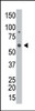 Antibody is used in Western blot to detect GALK2 in HL-60 cell lysate.