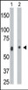 Antibody is used in Western blot to detect CERK in mouse heart tissue lysate (Lane 1) and A2058 cell lysate (Lane 2) .