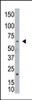 Antibody is used in Western blot to detect NEK8 in A2058 cell lysate.