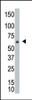 Antibody is used in Western blot to detect NEK8 in A2058 cell lysate.