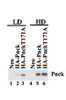 Neo, HA-Pnck and HA-Pnck T171A HEK-293 cells were plated at low (LD) and high (HD) cell density and lysates prepared after 48 hours. Equal amounts of total protein were immunoblotted for HA-Pnck (WB: Pnck) expression.