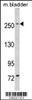 Western blot analysis of LRRK1 in mouse bladder tissue lysates (35ug/lane)