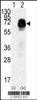 Western blot analysis of AMHR2 using rabbit polyclonal AMHR2 Antibody (N-term R80) using 293 cell lysates (2 ug/lane) either nontransfected (Lane 1) or transiently transfected with the AMHR2 gene (Lane 2) .