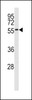 Western blot analysis of MNK2 (MKNK2) antibody in 293 cell line lysates (35ug/lane)