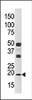 Western blot analysis of anti-NME3 Pab in CEM cell line tissue lysate (35ug/lane)