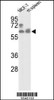 Western blot analysis of hPANK1-R90 in MCF-7 cell line and mouse spleen tissue lysates (35ug/lane)