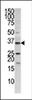 Western blot analysis of anti-PANK3 in HepG2 cell line lysate (35ug/lane) .