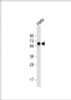 Western Blot at 1:1000 dilution + Hela whole cell lysate Lysates/proteins at 20 ug per lane.