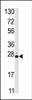 Western blot analysis of anti-STK19 Pabin HL60 cell line lysate (35ug/lane) .