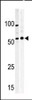 Western blot analysis of anti-PKMYT1 Pabin A375 (left) and Y79 (right) cell line lysate.