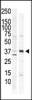 Antibody is used in Western blot to detect CAMK1 in HeLa cell lysate (lane 1) and primate brain tissue lysate (lane 2) .